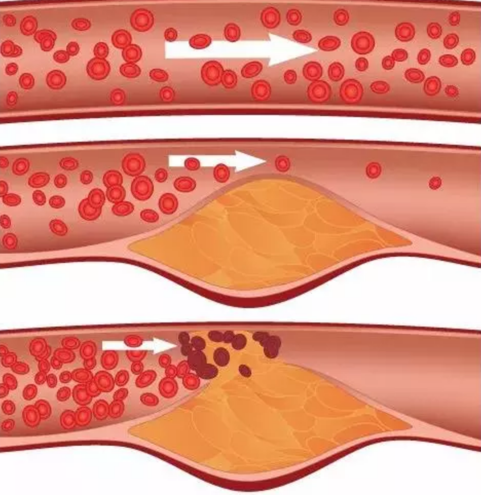 1573020829208830.png 屏幕快照 2019-11-06 下午2.13.35.png